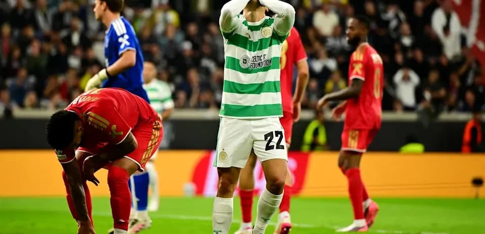 Joueur de Celtic montrant des signes de déception