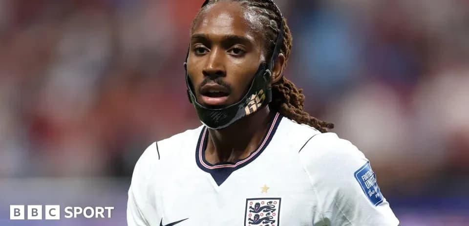 Joueur anglais portant un masque sur le terrain