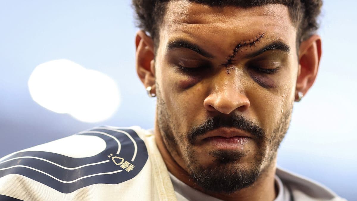 Joueur avec des blessures au visage avant le match
